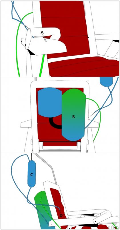 Die Arteriennadel A befindet sich an der Armlehne, der Dialysator B an der Rückenlehne, der Infusionsbeutel C führt das unverbesserte Blut über die Venennadel D zurück in den Körper.